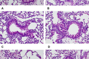 Ngũ gia bì gai ức chế phản ứng viêm do lipopolysacarit gây ra trong ống nghiệm và in vivo.